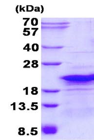SDS-PAGE - Recombinant Human RPL26L1 protein (AB134605), expandable thumbnail