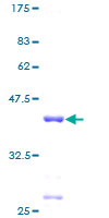 SDS-PAGE - Recombinant Human RPL30 protein (AB159392), expandable thumbnail