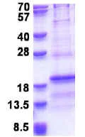SDS-PAGE - Recombinant Human RPL31 protein (AB176043)
