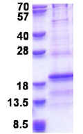SDS-PAGE - Recombinant Human RPL31 protein (His tag N-Terminus) (AB176043)