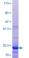SDS-PAGE - Recombinant Human RPL32P3 protein (AB165362)