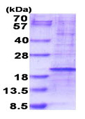 SDS-PAGE - Recombinant Human RPL35 protein (denatured) (AB187442)