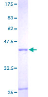 SDS-PAGE - Recombinant Human RPL36A protein (AB159415)