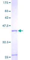 SDS-PAGE - Recombinant Human RPL36A protein (AB159415)