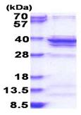 SDS-PAGE - Recombinant Human RPL5 protein (His tag N-Terminus) (AB183222)