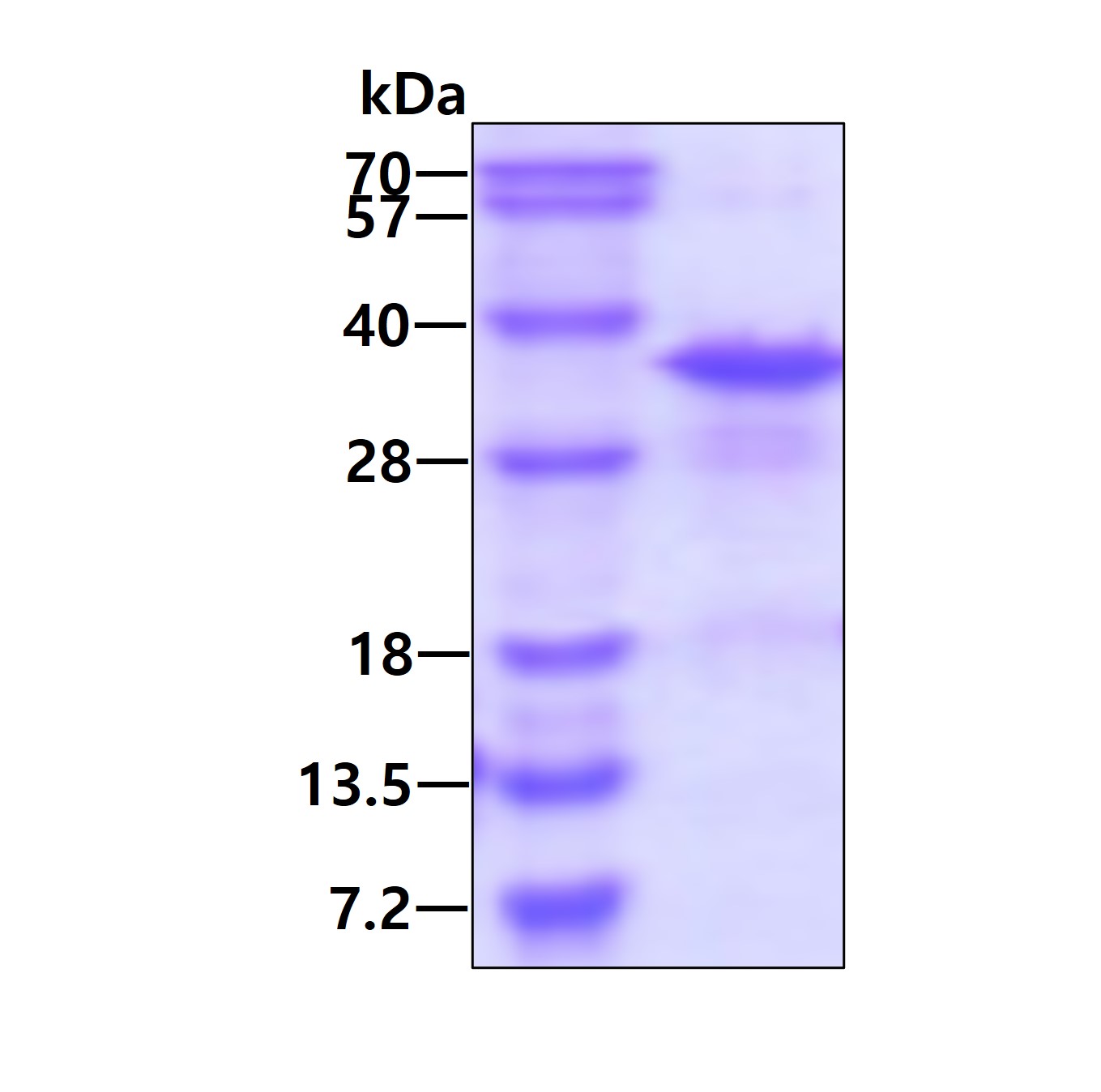 SDS-PAGE - Recombinant Human RPL8 protein (AB123188)