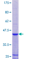 Recombinant Human RPLP1 protein