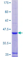 SDS-PAGE - Recombinant Human RPLP1 protein (GST tag N-Terminus) (AB159420)