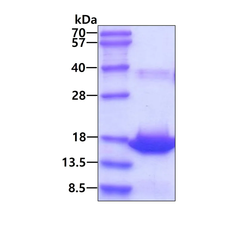 SDS-PAGE - Recombinant Human RPLP2 protein (His tag N-Terminus) (AB123191)