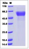 SDS-PAGE - Recombinant Human RPN2 protein (His tag) (AB276632)