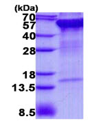 SDS-PAGE - Recombinant Human RPN2 protein (His tag N-Terminus) (AB139620)