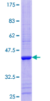 Recombinant Human RPP14 protein