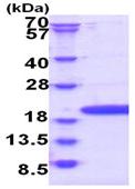 SDS-PAGE - Recombinant Human RPP20 protein (AB180270)