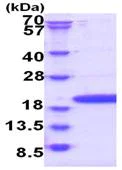 SDS-PAGE - Recombinant Human RPP20 protein (AB180270)