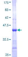 SDS-PAGE - Recombinant Human RPP29 protein (AB161151)