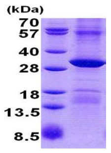 SDS-PAGE - Recombinant Human RPP29 protein (denatured) (AB140731)