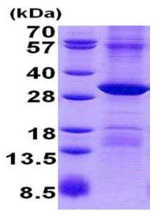 SDS-PAGE - Recombinant Human RPP29 protein (denatured) (AB140731)