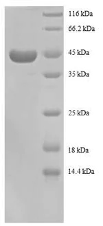 SDS-PAGE - Recombinant Human RPS13 protein (Tagged) (AB240762)