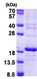 SDS-PAGE - Recombinant Human RPS16 protein (denatured) (His tag N-Terminus) (AB167882)