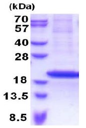 SDS-PAGE - Recombinant Human RPS18 protein (denatured) (His tag N-Terminus) (AB171466)
