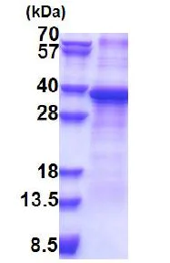 SDS-PAGE - Recombinant Human RPS2 protein (denatured) (His tag N-Terminus) (AB171474)