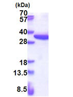 SDS-PAGE - Recombinant Human RPS4X/SCAR protein (His tag N-Terminus) (AB174424)
