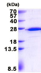 SDS-PAGE - Recombinant Human RPS5 protein (AB137146), expandable thumbnail