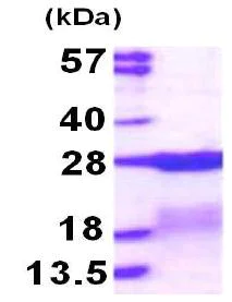 SDS-PAGE - Recombinant Human RPS7 protein (AB117224)
