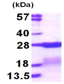 SDS-PAGE - Recombinant Human RPS7 protein (His tag N-Terminus) (AB117224)