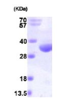 SDS-PAGE - Recombinant Human RQCD1 protein (His tag N-Terminus) (AB101208)