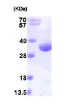 SDS-PAGE - Recombinant Human RQCD1 protein (His tag N-Terminus) (AB101208)