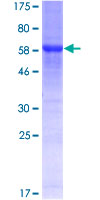 SDS-PAGE - Recombinant Human RRAGB protein (GST tag N-Terminus) (AB160946)