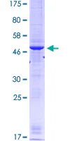 SDS-PAGE - Recombinant Human RRM1 protein (GST tag N-Terminus) (AB152668)