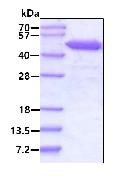 SDS-PAGE - Recombinant Human RRM2 protein (AB99137)