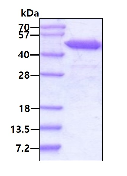 SDS-PAGE - Recombinant Human RRM2 protein (His tag N-Terminus) (AB99137)