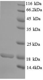 Recombinant Human RRP2 protein (His tag)