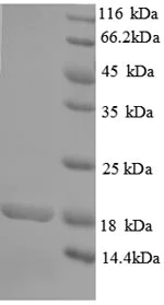 SDS-PAGE - Recombinant Human RRP2 protein (His tag) (AB236185)