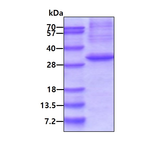 SDS-PAGE - Recombinant Human RRP41 protein (denatured) (AB176048)