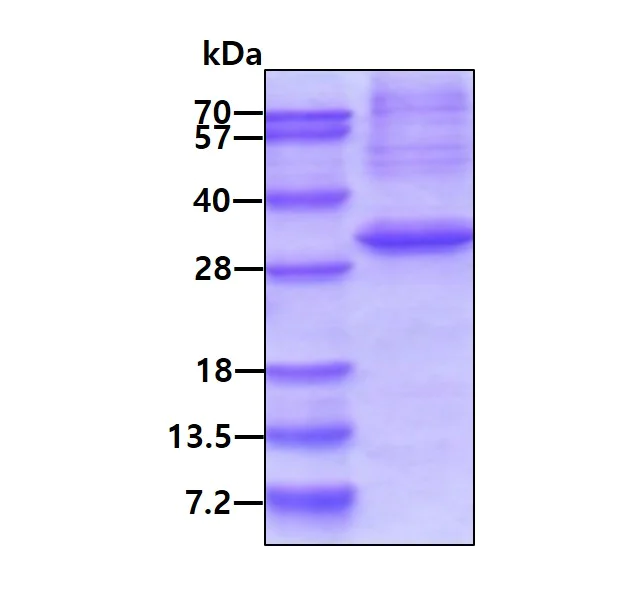 SDS-PAGE - Recombinant Human RRP41 protein (denatured) (His tag N-Terminus) (AB176048)