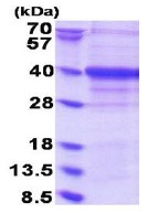 Recombinant Human RRP42 protein
