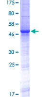 Recombinant Human RS1 protein