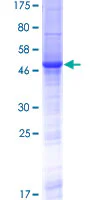 SDS-PAGE - Recombinant Human RS1 protein (GST tag N-Terminus) (AB159464)