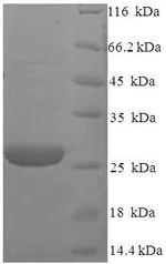 SDS-PAGE - Recombinant Human RS1 protein (His tag) (AB235974)