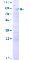 Recombinant Human RSBN1/Rosbin protein