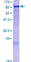 SDS-PAGE - Recombinant Human rSec6 protein (AB153182), expandable thumbnail