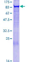 SDS-PAGE - Recombinant Human rSec6 protein (GST tag N-Terminus) (AB153182)