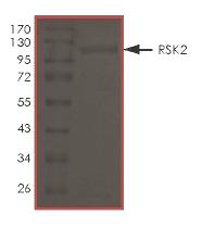 SDS-PAGE - Recombinant human Rsk 2 / MAPKAP Kinase 1b (mutated L608F) protein (AB172182), expandable thumbnail