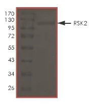 SDS-PAGE - Recombinant human Rsk 2 / MAPKAP Kinase 1b (mutated L608F) protein (AB172182)