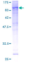 Recombinant Human RSK1 p90 protein