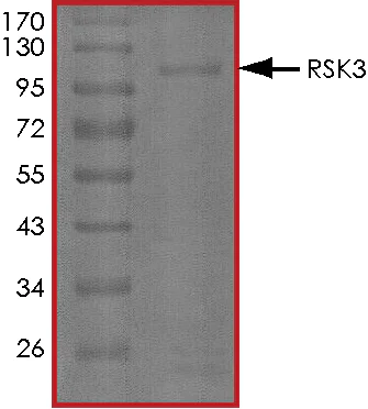 SDS-PAGE - Recombinant human RSK3 protein (AB60882)